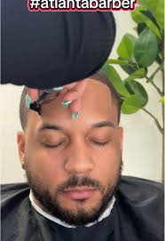 Exclusive Hairline Retention Services in Atlanta