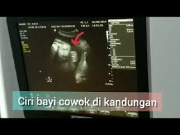 Download now syahnaz sadiqah hamil 8 minggu hasil usg tunjukkan dua janin. Kelamin Janin Hasil Gambar Usg Bayi Perempuan