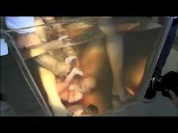 Breech Does Not Equal C Section Water Birth Birth Videos Breech Birth