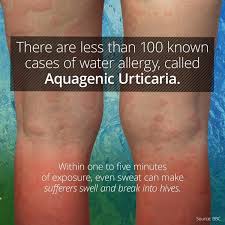 Pin On Medical Phenomena