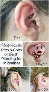 Migraine Piercing 1 Year Results Daith Piercing Migraine Migraine Piercing Natural Headache Remedies