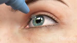 May 22, 2019 · signs you're overusing eye drops. 10 Expert Tips For Using Glaucoma Eye Drops Brightfocus Foundation