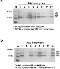 Image result for Black 1999 AAV