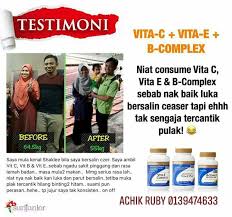 Ilustrasi ibu yang baru melahirkan. Luka Bersalin Lambat Sembuh