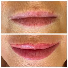 Check spelling or type a new query. 60 Best Cosmetic Lip Tattoo Salon In Melbourne 2021