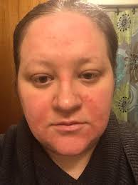 What moisturizer can be used at night with a CPAP mask?