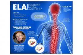 Por medio de la presente se informa que todo pedido de medicación deberá cumplir con los siguientes requisitos. Noticia Hoy Es El Dia Mundial De La Esclerosis Lateral Amiotrofica