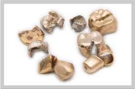 Goldkurs Und Goldpreis Pasigo