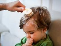 Image result for what is treatment for ringworm on scalp