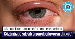 Doktorlar Uyariyor Gozunuzde Sik Sik Arpacik Cikiyorsa Dikkat Doktorlar Saglik Saglikli