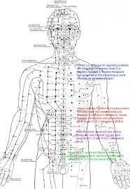 image result for acupuncture needle placement acupuncture