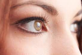 Maybe you would like to learn more about one of these? Lassen Sie Sich Mit Mandelaugen Mehr Ausdruck Verleihen Dr Med Guncel Ozturk