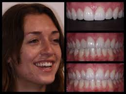 THE BEST 10 ENDODONTISTS in REDONDO BEACH, CA