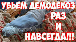 как избавиться от подкожного клеща на лице в домашних условиях Demodekoz Lechenie Kak Pravilno Lechit Demodekoz Na Lice Lico Zdorove Maski Dlya Lica