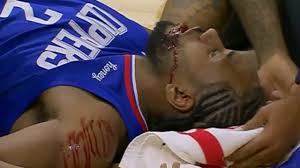 In this we talk about kawhi's injury thank you for watching!! Nba 2020 Kawhi Leonard Elbowed Bleeding Golden State Warriors 60 Year Low Lebron James Airball The Weekly Times