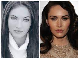 Pense rápido em angelina jolie e megan fox. Saiba Tudo Sobre A Bichectomia Como E A Cirurgia Quais Os Riscos E Quanto Custa Virgula