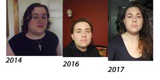 Levitt provides a simpler description of trans woman. Timeline Current Shots M2f 25 4 Mth Hrt How Am I Doing Album On Imgur