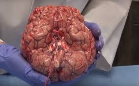Image result for brain