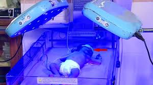Image result for Phototherapy