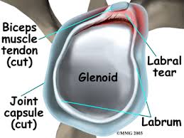 Image result for SLAP Lesion