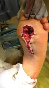 Maybe you would like to learn more about one of these? Anson Mount On Twitter Fuck You Outdoors You Cruel Bastard Rt Outdoorsceo A 270 In The Foot Nasty Http T Co Ujyouxfzya