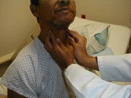 Lymph nodes in neck, groin, armpit & throat. Uc San Diego S Practical Guide To Clinical Medicine