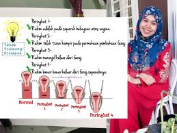 Sebagian besar orang percaya, perempuan yang masih perawan akan mengeluarkan darah saat malam pertama. Simptom Tombong Lelaki Perempuan Pun Akan Kena Tapi Berhentilah Takutkan Kaum Wanita My Info Maya