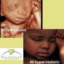 TOP 10 BEST 3d Ultrasound near Kyle, TX