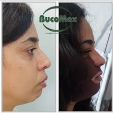 Fabio Faria (@bucomaxcirurgia) • Instagram फोटोहरू र भिडियोहरू