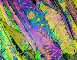 Image result for Polarized Microscopy