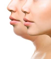 It contains vitamins, glycerin, collagen, and seaweed to moisturize and plump while you sleep. Ultherapy The Breakthrough Treatment That Tightens Jowls With Ultrasound Energy Amour Medical Aesthetics Inc Internists