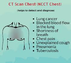 The ct scan cost not only varies from facility to facility, it varies massively between u.s. Get 60 Off On Ct Scan Chest Cost In Hyderabad 3825 Only Mfine Co