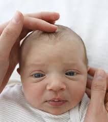 4 Worrisome Symptoms Of Wheat Allergy In Babies/Infants