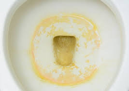 The water can even overflow when it doesn't flow at all. How To Get Rid Of Toilet Bowl Ring Naturally Homemade Limescale Remover Helth