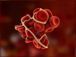 Un compus cu o structura noua si un astfel, pentru un singur medicament inovativ pot exista pana la 12 variante generice, care au aceeasi substanta activa si acelasi efect terapeutic. Cabinet Cardiologie Dr Olteanu Florin Tratamentul Anticoagulant Oral DatoritÄ Unor Probleme De SÄnÄtate Vi S A Indicat Un Tratament Cu Trombostop Sau Sintrom Sau Cu Alte Medicamente Care ConÅ£in Aceeasi SubstanÅ£Ä ActivÄ