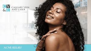 Youthful Complexion with Lumecca IPL Rejuvenation