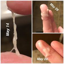 Thick White Discharge And Three Negative Pregnancy Tests Babycenter