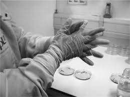 The best thickener would be an alcohol based hair gel, because it will not curdle and will mix. Hand Sanitizer An Overview Sciencedirect Topics