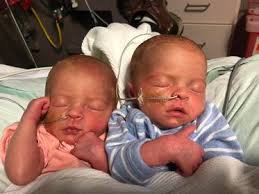 I wanted to paint a picture of what NICU life is like. It's a roller  coaster. A premie baby is not supposed to be doing this list of things we  are asking