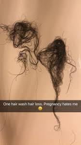 Hormonal changes during pregnancy affect all women differently. Hair Loss During Pregnancy Babycenter
