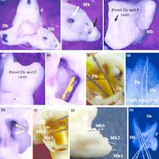 Bud and tween are synonymous, and they have mutual synonyms. Pdf Anatomical Challenges Electronic Working Length Determination And Current Developments In Root Canal Preparation Of Primary Molar Teeth