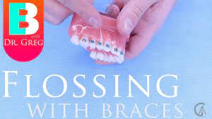 Read this post on how to get braces to… How To Floss With Braces Superfloss Platypus Softpicks Etc Youtube