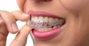 Over 4 million americans wear braces. From Start To Finish What To Expect From The Invisalign Process