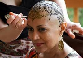 This Is A Great Idea For Woman Losing Their Hair Due To Chemotherapy Crown Tattoo Scalp Tattoo Henna Tattoo