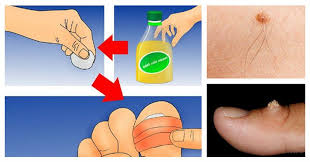 Pin On Health Fitness