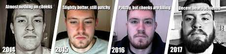 Growing a full, glorious beard can be tough. Grow Your Beard Faster 9 Proven Methods Research Backed