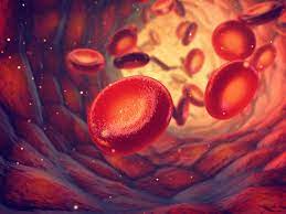 Haemophilia a (or hemophilia a) is a genetic deficiency in clotting factor viii, which causes increased bleeding and usually affects males. Hemofilia A Gejala Penyebab Cara Mengobati Dll Doktersehat