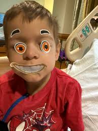 Rey Update** **Still in the hospital recovering with antibiotics**  **Needed**