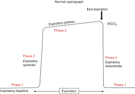 It also assists in the placement of an endotracheal or nasotracheal tube. Capnography I Springerlink
