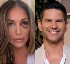 The Valley Star Danny Booko speaks out after shocking video released by Nia  Sanchez allegedly claims he abused her, as doctors warn the damage to her  eye could permanently affect her vision